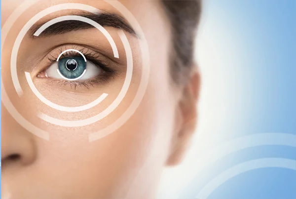 LASIK